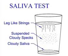 Candida Saliva Test